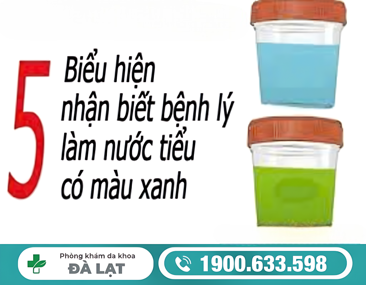 Hình ảnh minh họa